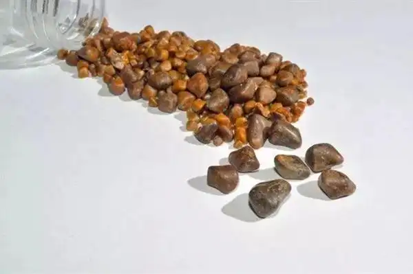 在标准光源条件下评定胆结石颜色