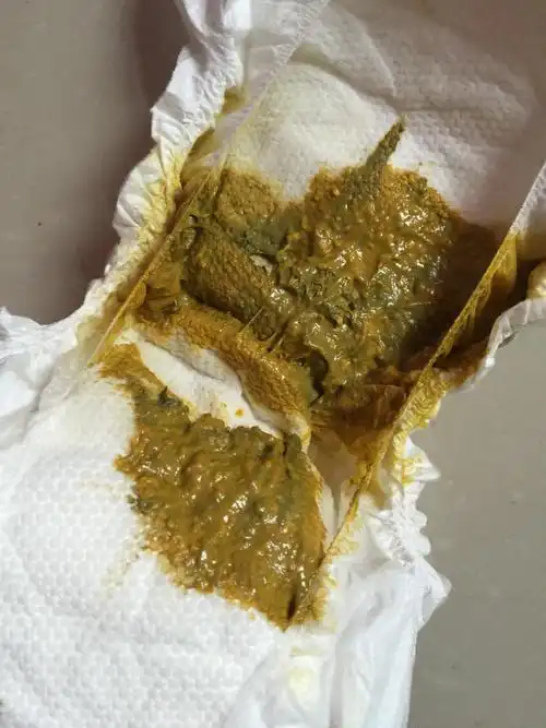 因为宝宝还小,消化系统比较弱但很重要,直接影响到宝宝对营养的吸收和