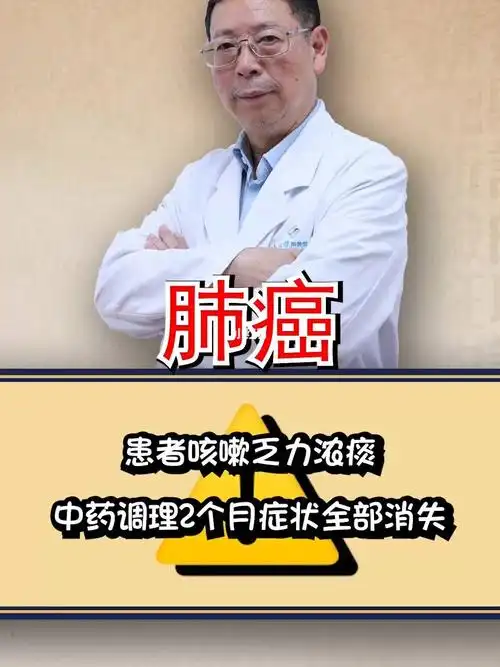 肺癌患者咳嗽乏力浓痰