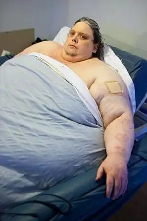 世界最胖的男人病逝.