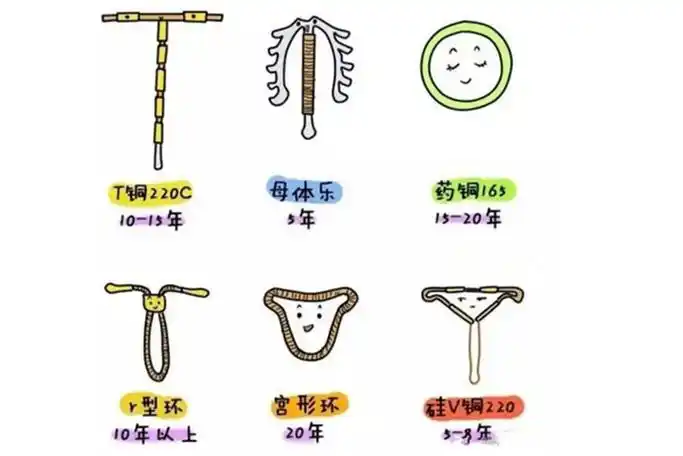 可分为四种型号,一旦上环后可以保持10-15的避孕效果,手术操作很简单