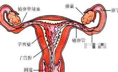 输卵管通而不畅怎么办 输卵管通而不畅有哪些症状