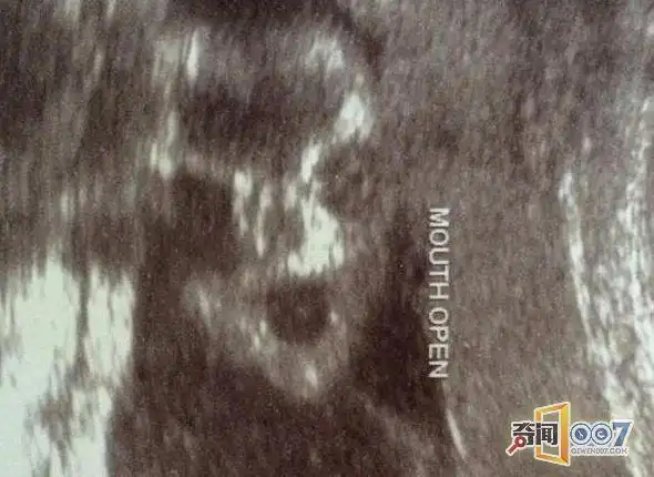 而这个胎儿有着完整的鹰钩鼻和长长的"利爪",从图像看来像是邪恶的