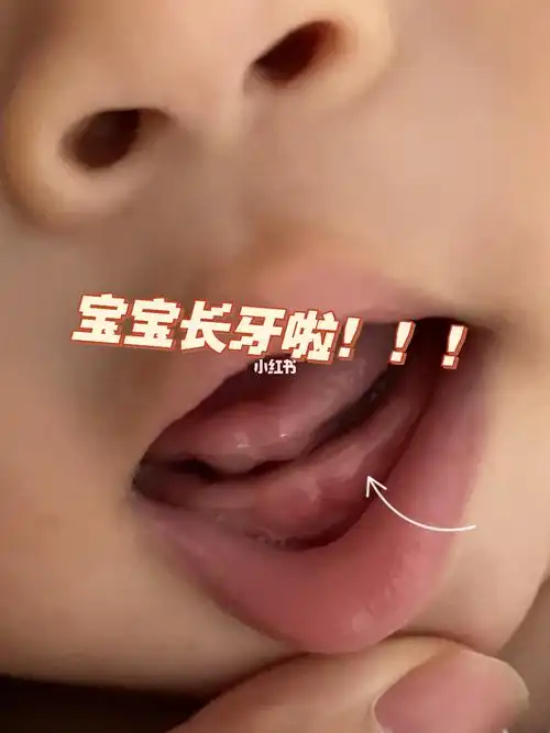 宝宝出牙  #宝宝长牙  #5个月宝宝  #母乳宝宝