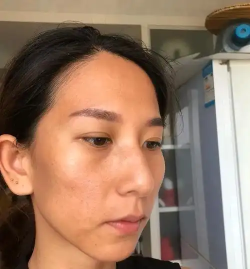 女人皮肤暗沉的原因有哪些?除了不要熬夜,还有这5点"不要做"