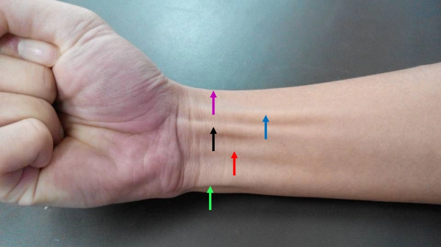 桡侧腕屈肌肌腱和尺侧腕屈肌肌腱:通过腕的对抗外力屈曲.