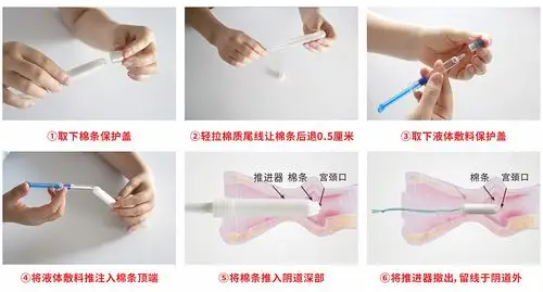 阴道填塞止血吸附栓使用方法