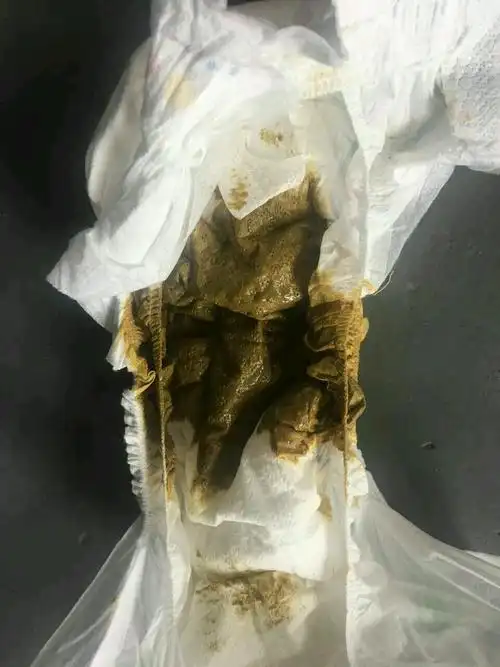 担心 有图慎入宝妈们宝宝最近一直拉绿屎前天感冒就一直拉了绿屎有