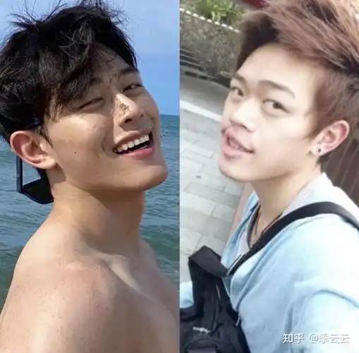 男生隆鼻干货分析——哪些男明星适合当隆鼻模板?(附真实案例)