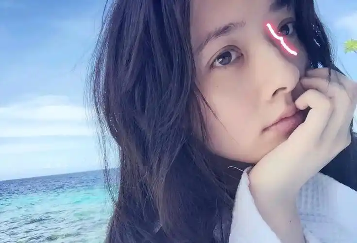 混血儿就会有驼峰鼻吗