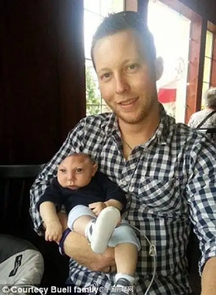 美无脑儿1岁啦曾被断言只能活几天