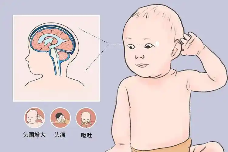 宝宝额头突出高怎么回事
