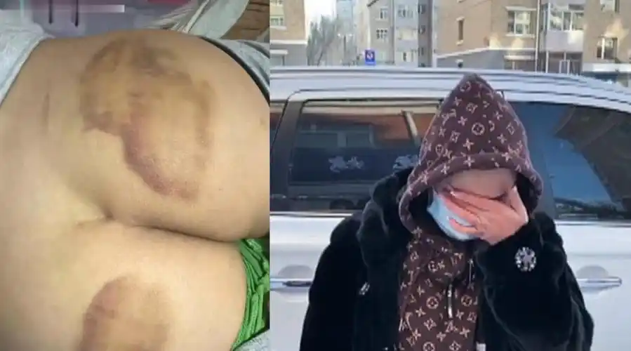 10岁孩子辅导班背古诗慢屁股被打青,家长已报警