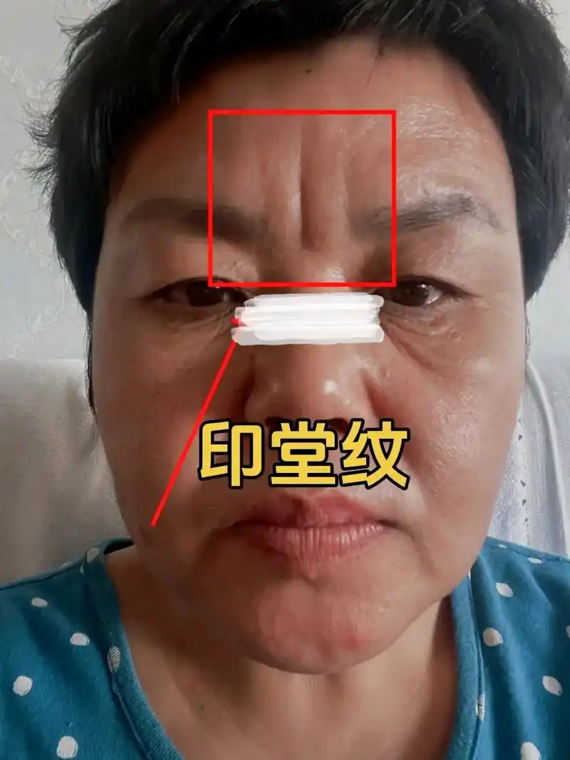 印堂纹#面相 #五官 #国学文化 - 抖音