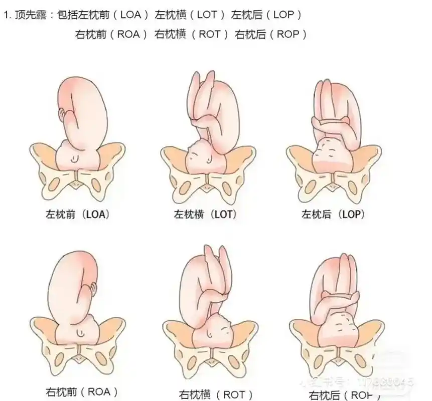 入盆后多久会生?