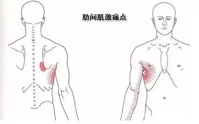胸痛病因:肋间肌和肋间隙筋膜病变 - 好大夫在线