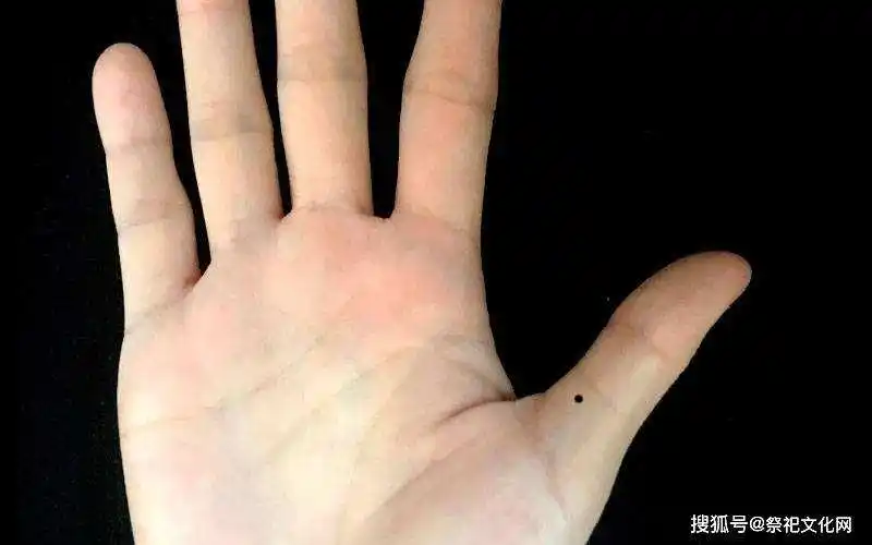 拇指通常主祖辈,如男性左手的大拇指有痣,则代表会接受到家里的祖产