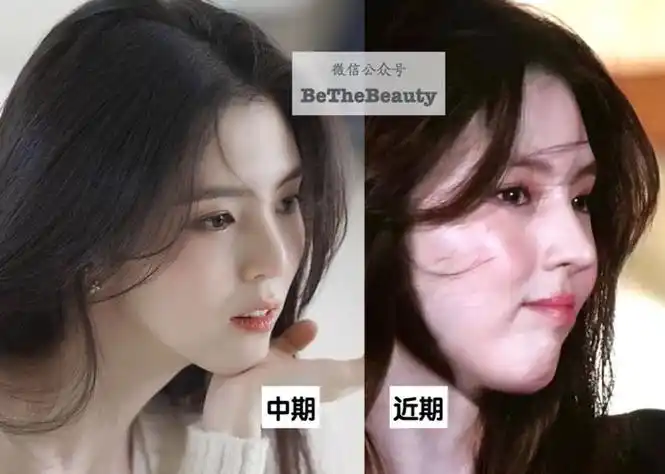 跟秀智对比,两人鼻子高度差不多,但韩依然有瘪进去的感觉鼻基底凹陷