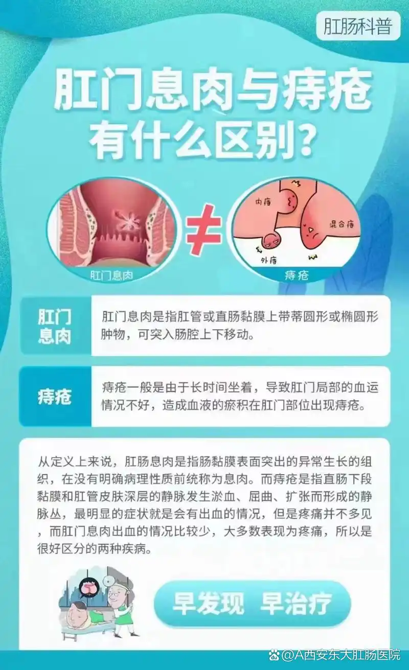西安东大肛肠医院丨肛门息肉和痔疮区别大,及时检查科学治疗才是正确