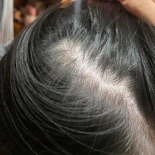 家人们我这个发缝正常吗需要去看医生吗