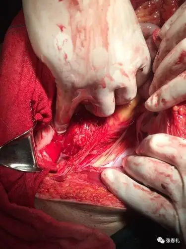 余年,经治的车或外伤患者因禁酒令已经减少很多,但是依然很多车祸患者