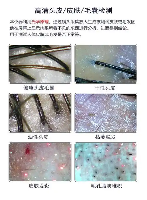 头皮检测仪理发店皮肤测试仪毛发高清毛囊检测仪器三光谱一体机