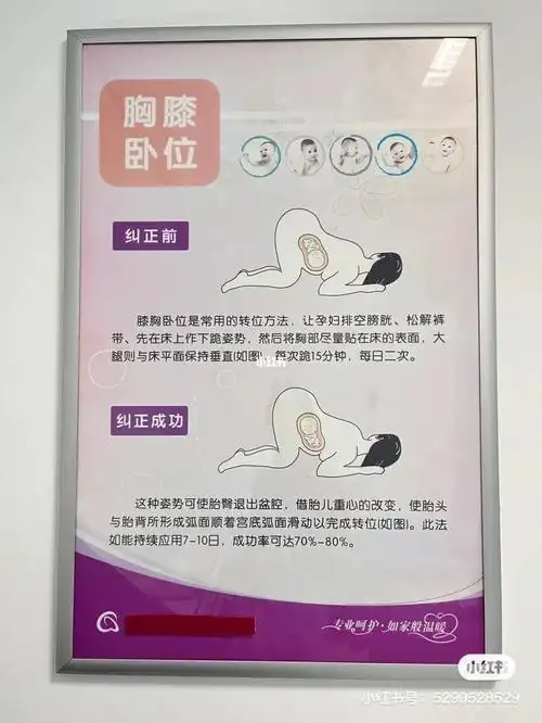 膝胸卧位是人干事?