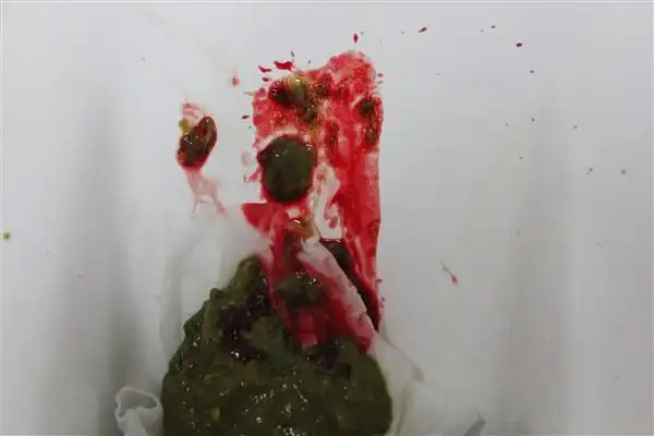 大便出血 您好,大便出血,但是是鲜红色的,手纸上 请问,肛裂大便出血