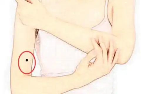 胳膊上有痣代表什么 男人手臂有痣含义解析