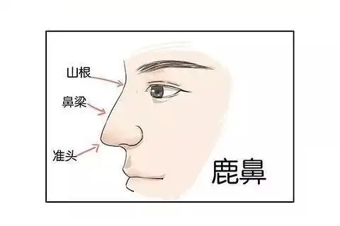 第一种:鹿鼻相学中鹿鼻的主要特点就是鼻型丰腴端正,整个鼻子都有肉