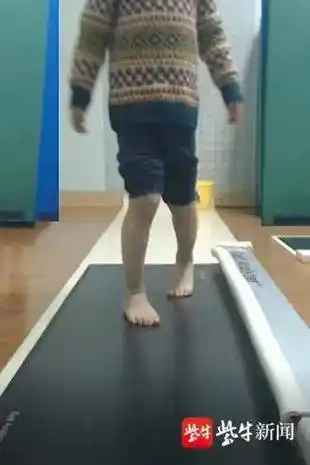 孩子走路"内八字",需要纠正吗?