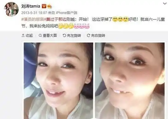 5位烤瓷牙明星,有的牙龈变灰,有的嘴包不住牙,一个比一个惨_刘涛_牙齿