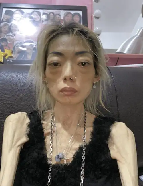 嫁入豪门如今瘦成骷髅,8年的婚姻生活,伍智恒究竟经
