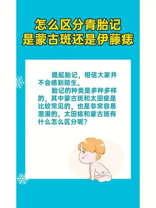 0000胎记的种类是多种多样的,其中蒙古斑和太田痣是比较常见的
