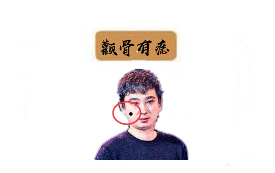 巨富痣,身体4颗黄金痣,个个挣大钱,行大运,万里挑一的好命!