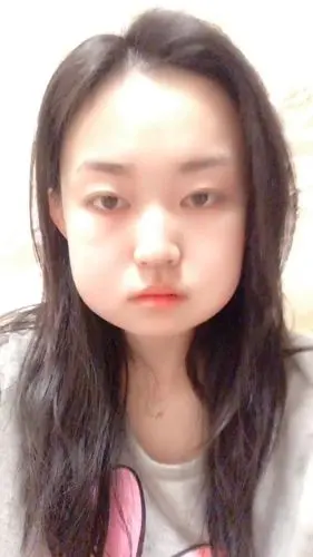 现在是凌晨两点三十二分,我因为拔智齿脸肿了火了……真的不是特效,是