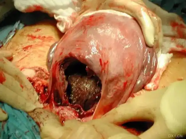 医学资讯_大夫e站