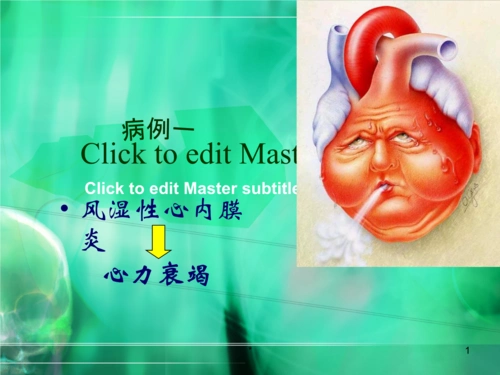 风湿性心内膜炎教程文件.ppt