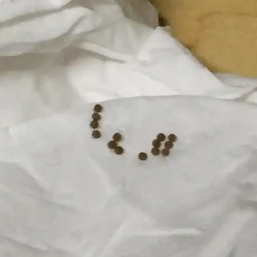 如图,宿舍衣服上及浴巾上有黄色颗粒状的类似飞蛾的卵,如何去除呢?