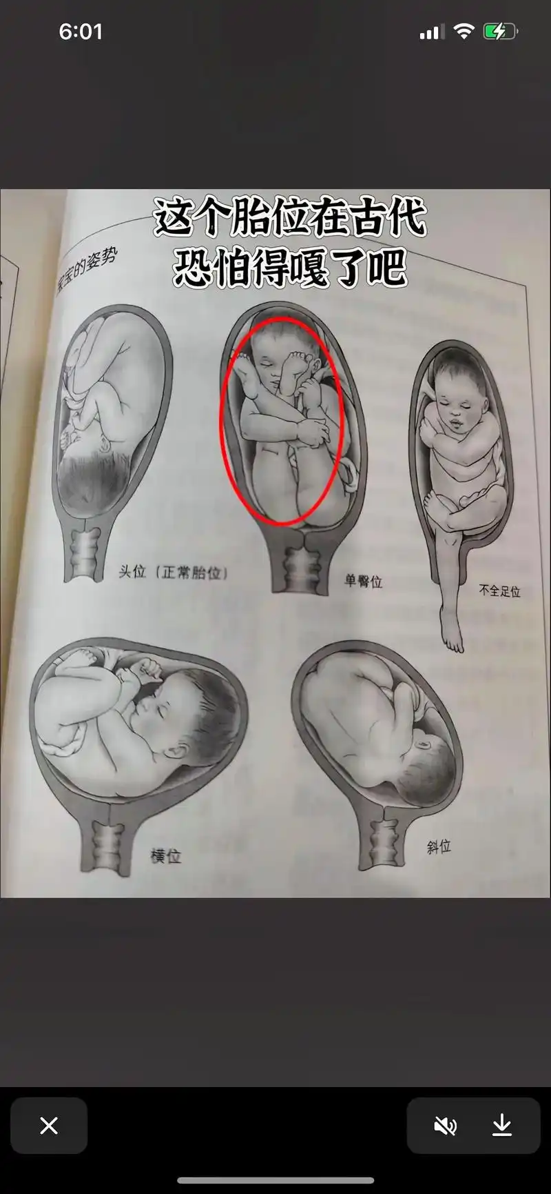 宝宝胎位 #胎儿在肚子里的胎位图 #胎位不正 #胎儿胎位图 - 抖音