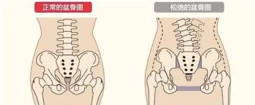 骨盆骨的连结,在前方有一关节,称为耻骨连结.