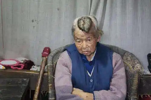 八旬老人头上长犄角误以为能真龙转世让人惊呆