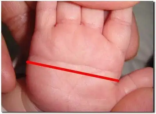 【热点】掌纹特殊不一定是异人之相,发现这种掌纹要当心