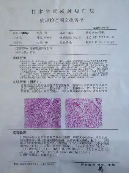 高龄进展期胃癌一例