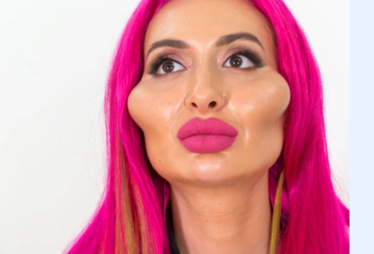 39岁乌克兰网红自称拥有世界最大脸颊?