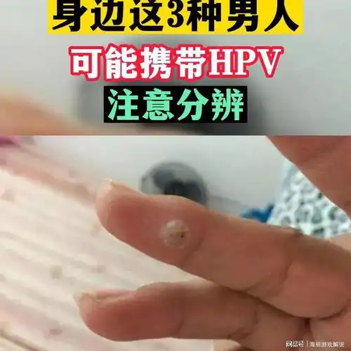 身边这3种男人可能携带hpv注意分辨