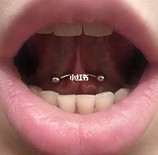 穿刺位置除了微笑钉 舌系带也了解一下吧_人体穿孔_时尚_时尚其他