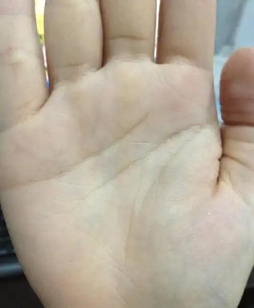 生命线细长深刻,金星丘饱满,体质较好.