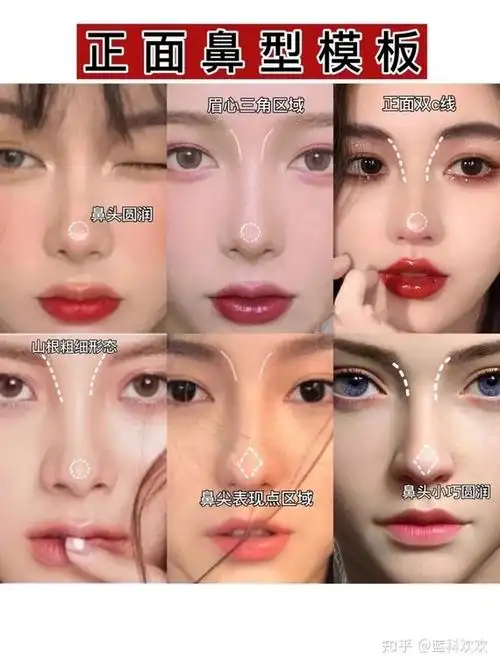 最全隆鼻术前沟通模板自己适合哪种鼻型鼻子存在哪些问题需要如何改善