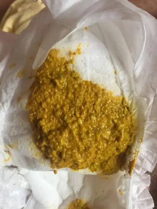 两个月小宝宝拉这样的粑粑正常吗